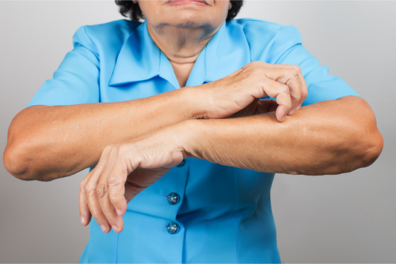 skin-dryness-and-itching-in-elders